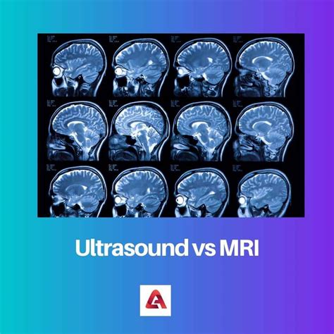 Ultrasound vs. MRI for Joint Issues 